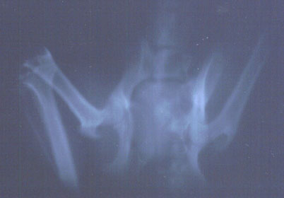 xray